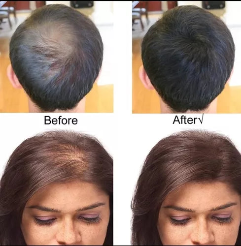 KIT FIBRAS CAPAILARES