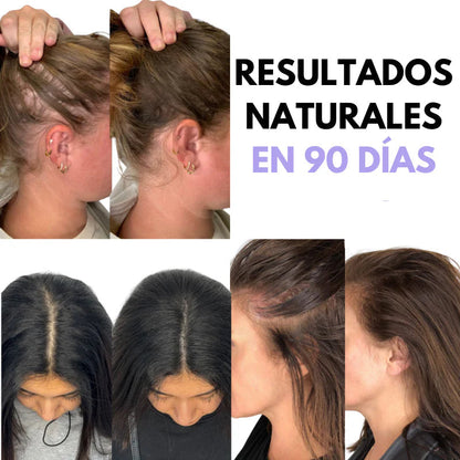 Cepillo Masajeador Capilar Portátil con Humidificador – Hidratación y Crecimiento en Casa